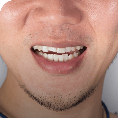 Orthodontic Dentistry | Absolute Dentistry | Family & General Dentist | Okotoks Dentist