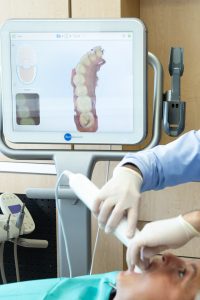 iTero Digital Scanner | Absolute Dentistry | Family & General Dentist | Okotoks Dentist