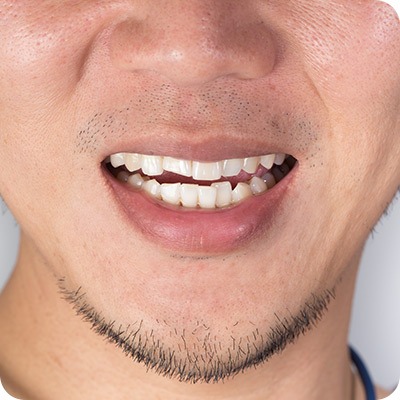 Orthodontics | Absolute Dentistry | Family & General Dentist | Okotoks Dentist